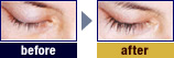 ラティースbefore_after