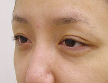 masaki_before111005_1.jpg