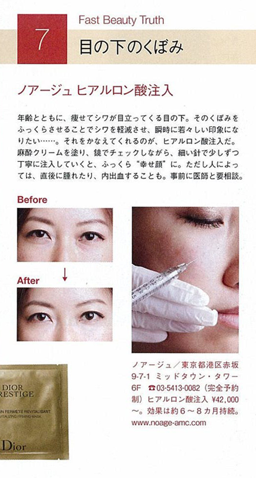 http://www.noage-amc.com/topics/vogue_1110_contents01.jpg