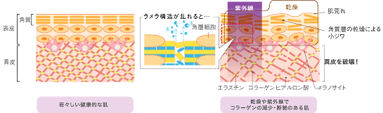 シワ・小ジワ